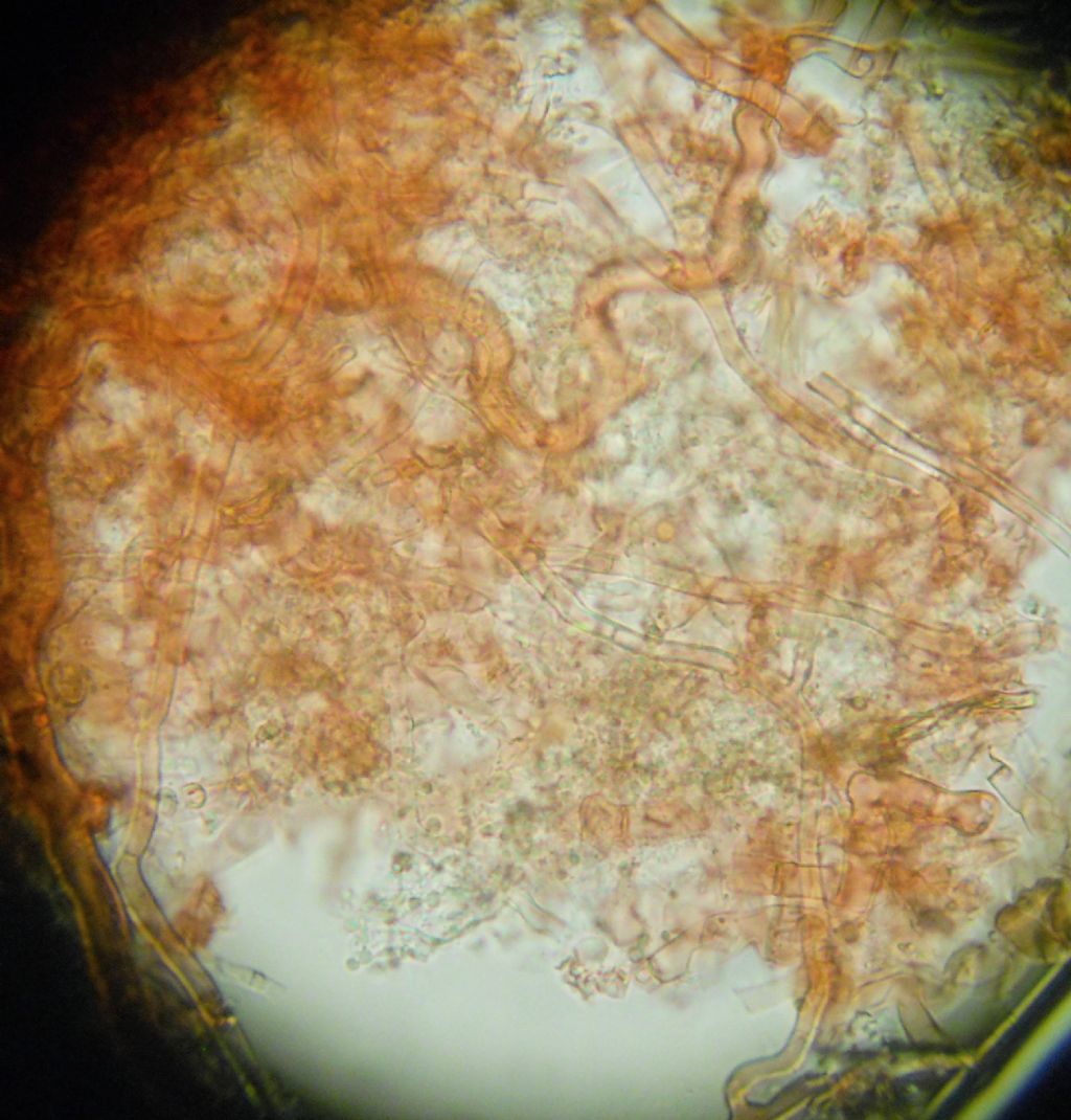 Botryobasidium? (Botryobasidium subcoronatum)